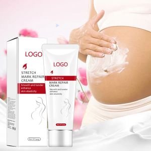Custom stretch mark treatment product packaging by ProCosmeticsOEM